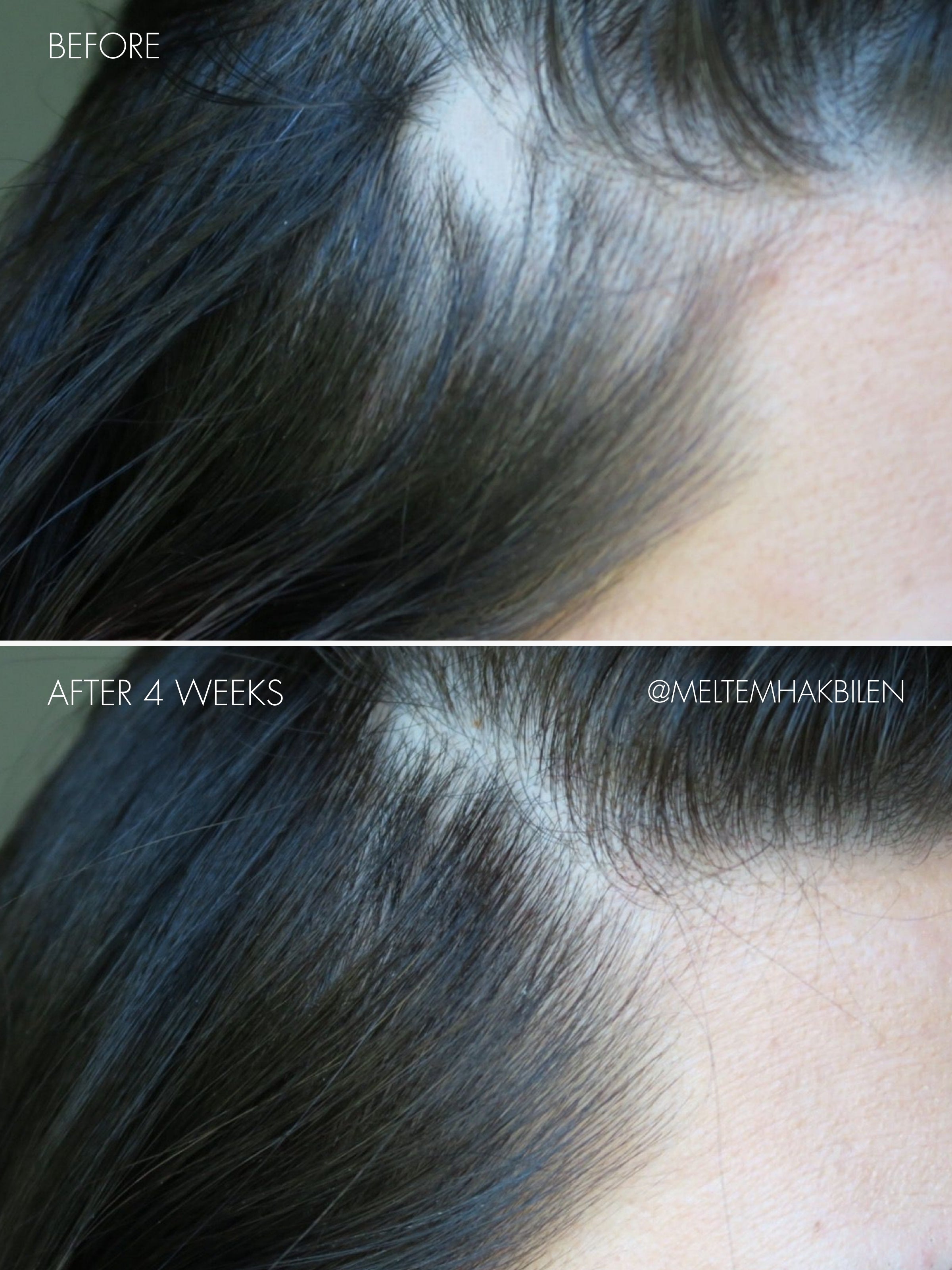 sweed-the-hair-serum-s-rum-capillaire-roll-on-biotine-peptides-et-k-ratine-cheve image 3