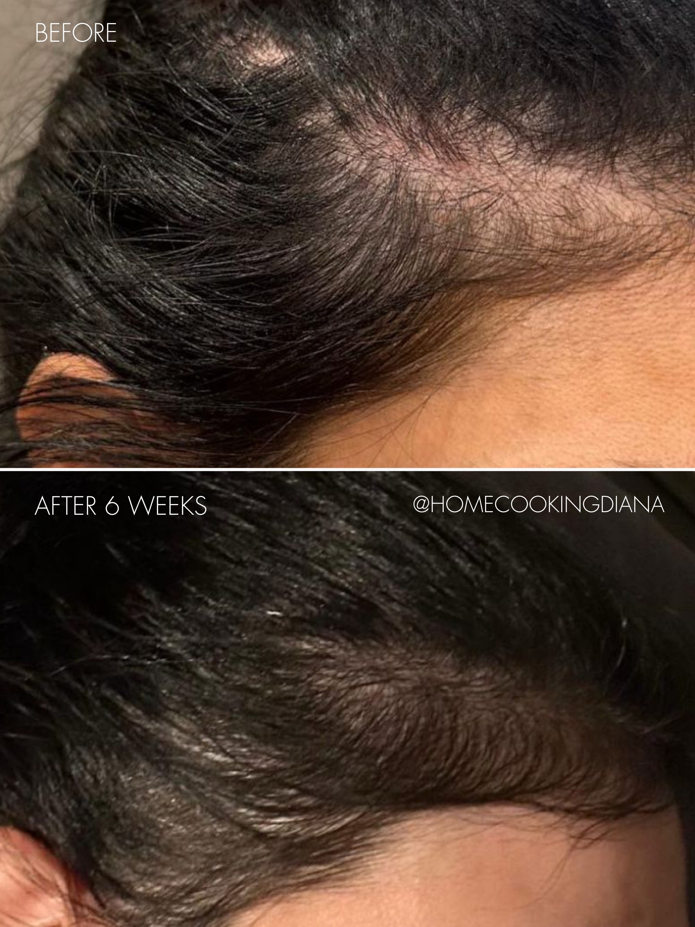 sweed-the-hair-serum-s-rum-capillaire-roll-on-biotine-peptides-et-k-ratine-cheve image 4