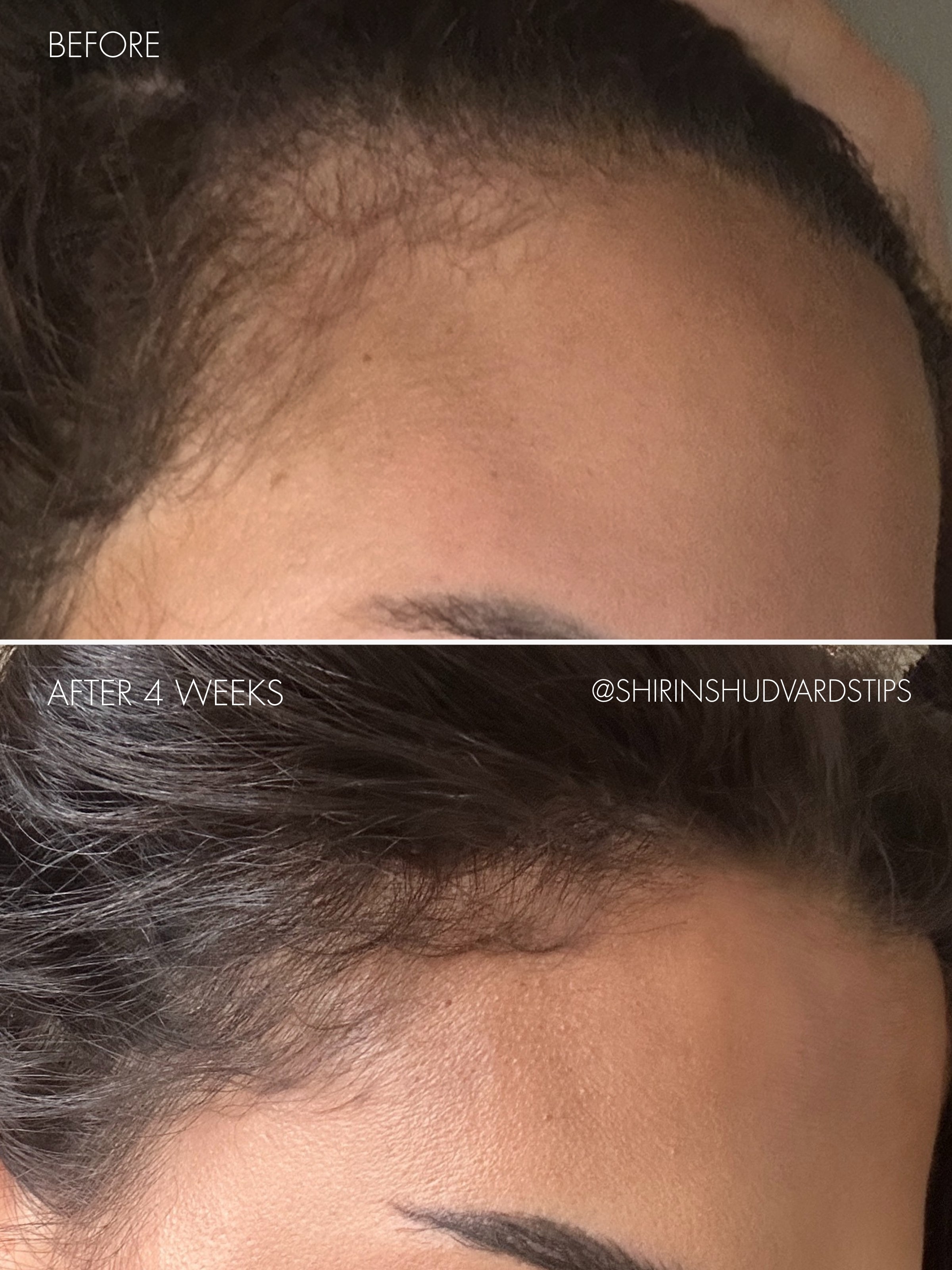 sweed-the-hair-serum-s-rum-capillaire-roll-on-biotine-peptides-et-k-ratine-cheve image 8