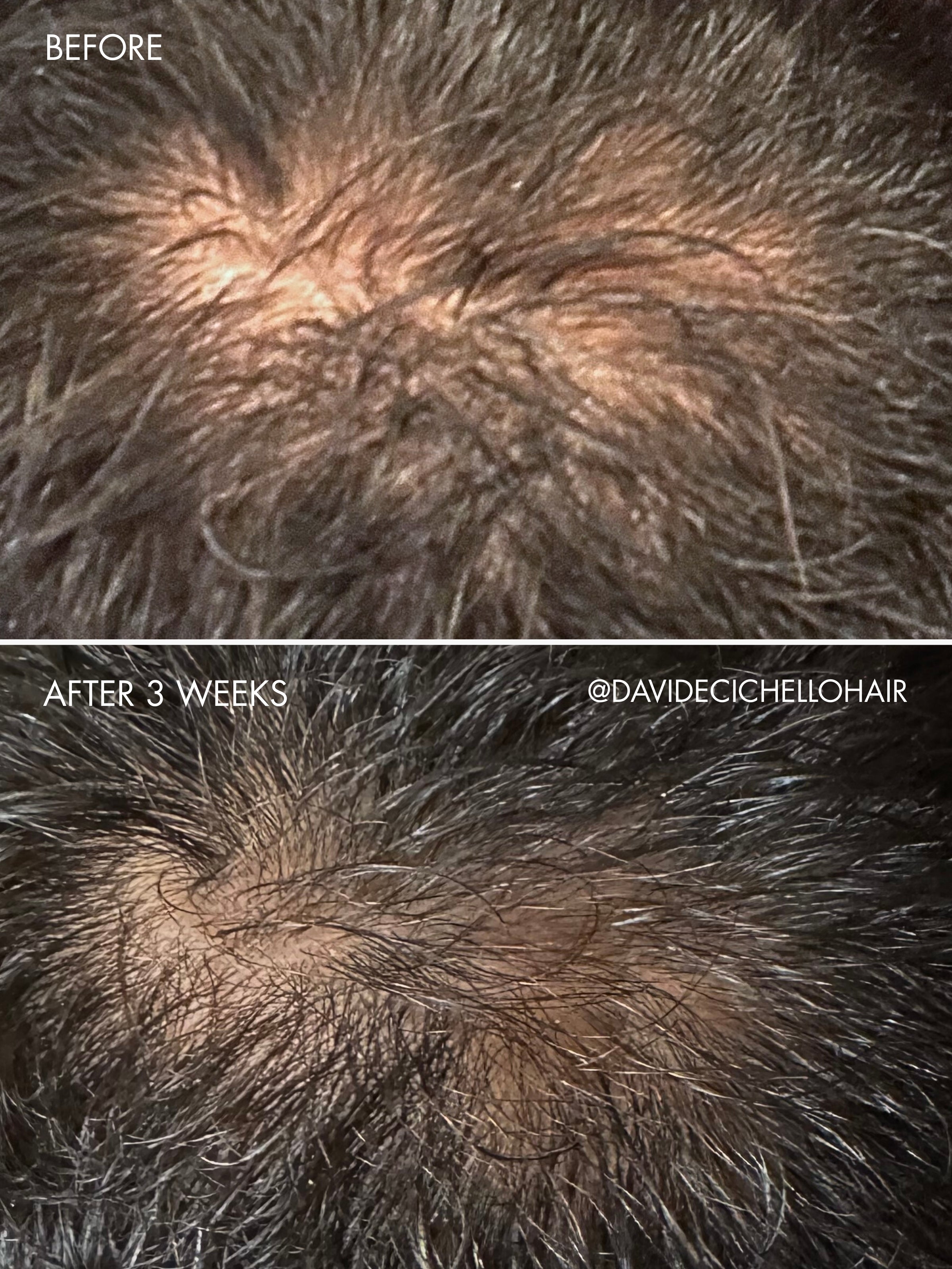 sweed-the-hair-serum-s-rum-capillaire-roll-on-biotine-peptides-et-k-ratine-cheve image 7